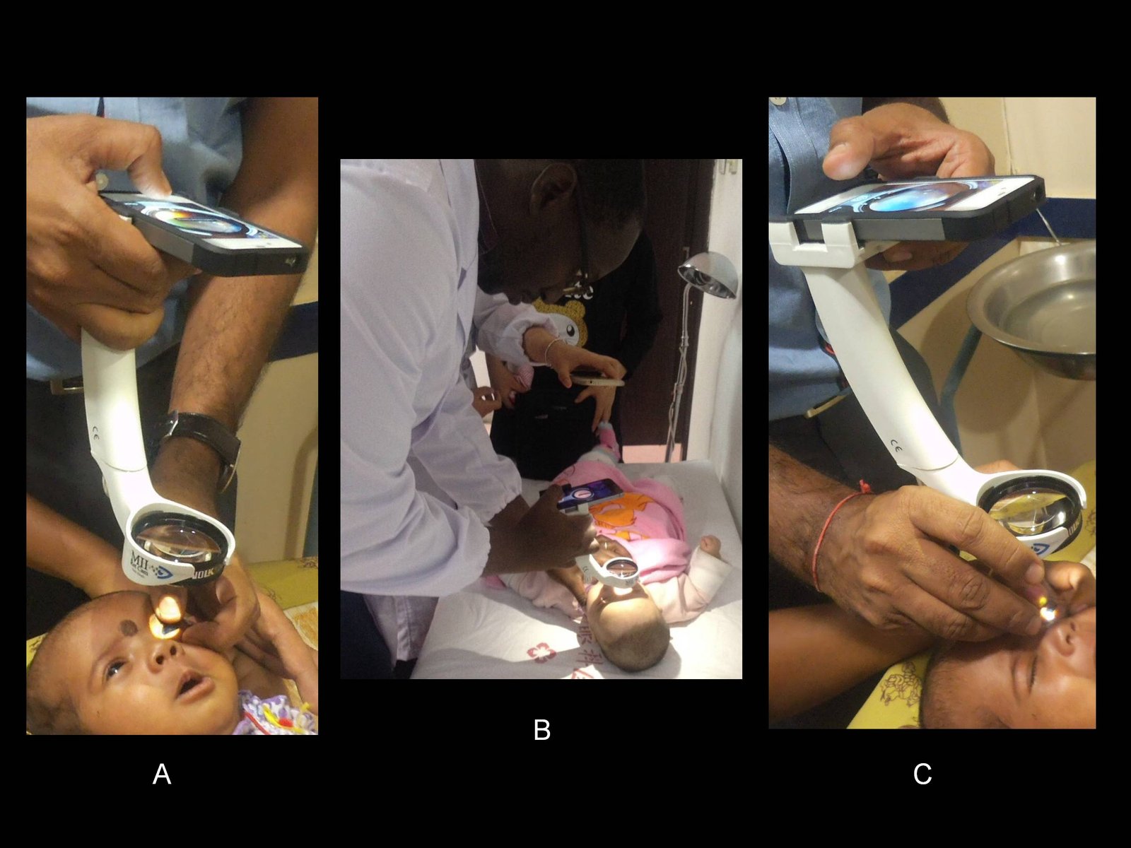 MII Ret Cam @Cameroon