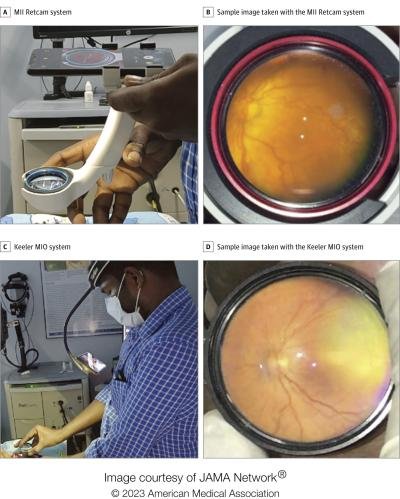 MII Ret Cam @ Aravind Eye Hospital ROP